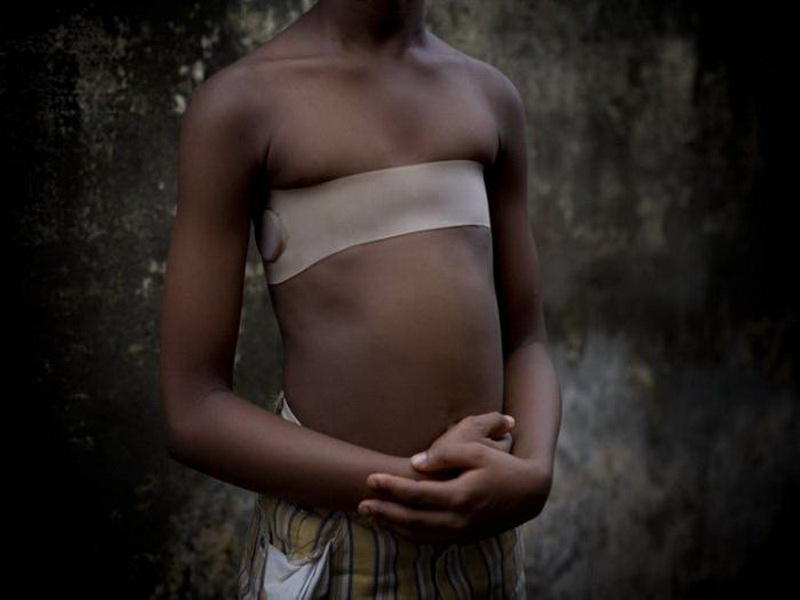 Cameroon-breast-Ironing-1
