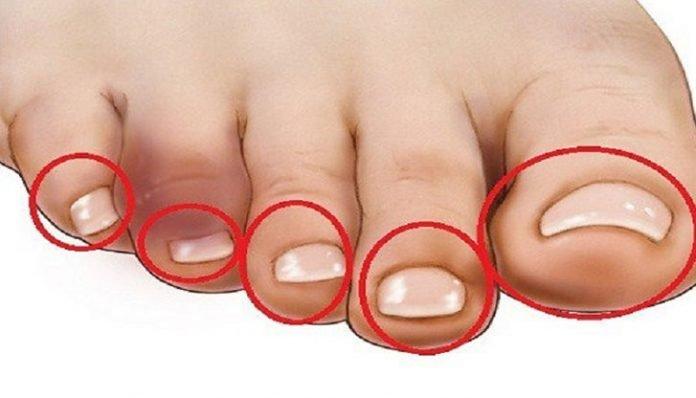 Прикоснитесь к пальцам Ваших ног, и Вы поймете, есть ли у Вас проблемы с сердцем (Читайте дальше)!