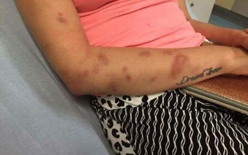 A DOMESTIC abuse victim has revealed sickening pictures of the horrific injuries she suffered at the hands of her former partner. Brave Kelsie Skillen was beaten to a pulp by her vicious boyfriend James McCourt, 19, at the home they shared together. The graphic pictures show her injuries after being subjected to a beating lasting four hours in June this year. Kelsie, 19, a make up artist from Bishopbriggs, near Glasgow, was rushed to hospital following the attack which left her with cuts to her face and covered in bruises. McCourt has been remanded in custody to await sentencing after he admitted the brutal assault during an appearance at Glasgow Sheriff Court. Kelsie said she wanted to warn other people about McCourt so that they don't suffer the same fate as her.
