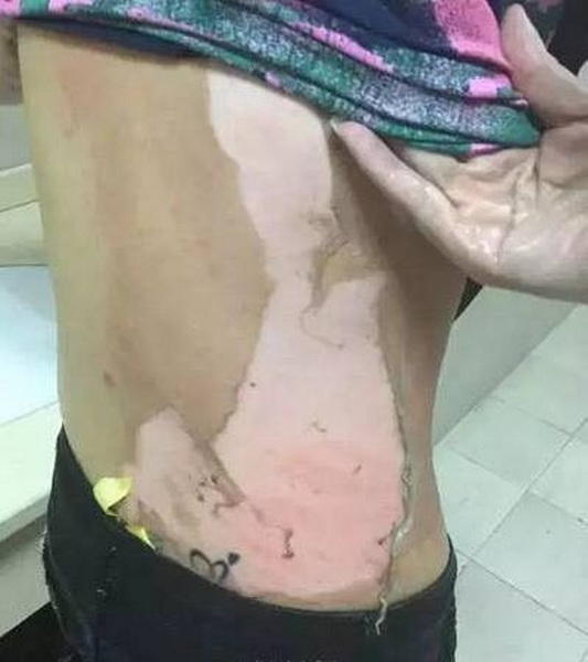 a-woman-who-was-brutally-1