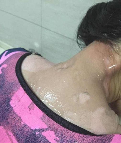 a-woman-who-was-brutally-2