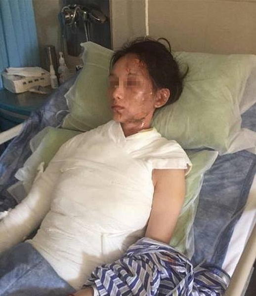 a-woman-who-was-brutally