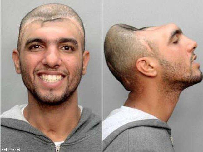 Самые невероятные травмы (8 фото)