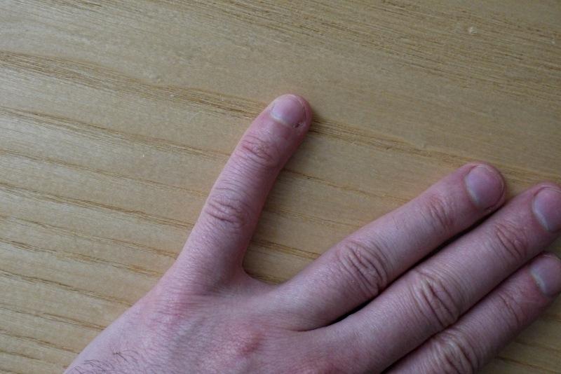 Лунки на ногтях – значение формы и цвета лунул для здоровья