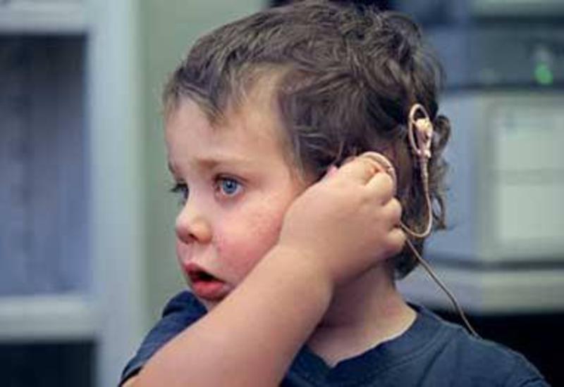 Глухонемой человек с рождения. Операция глухонемым с рождения. Как покажи операция глухой.