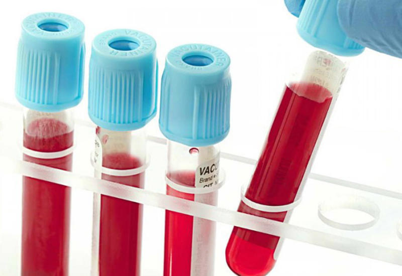 9 показателей крови, которые расскажут все о вашем здоровье