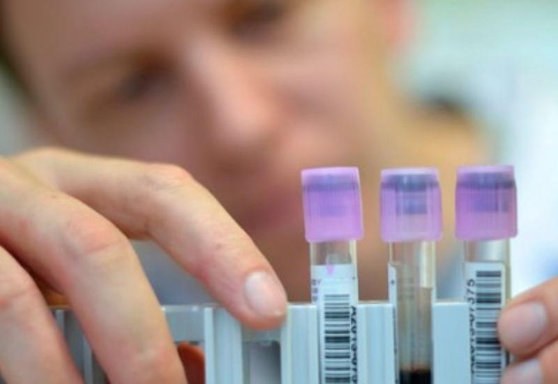 Çexiyada qrip epidemiyasından 65 nəfər ölüb