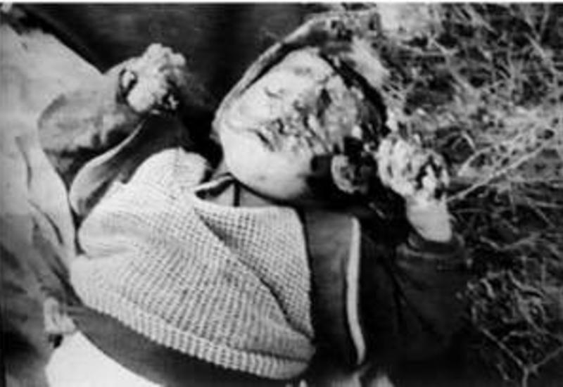 Геноцид в Ходжалы - одно из самых чудовищных преступлений ХХ века