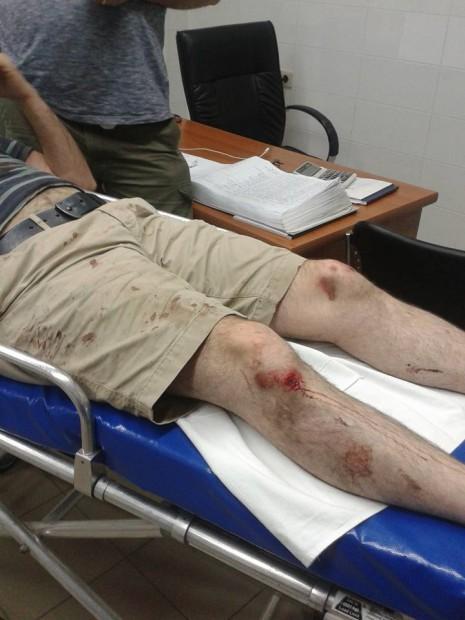 На митинге в Ереване жестоко избит доцент-арабист