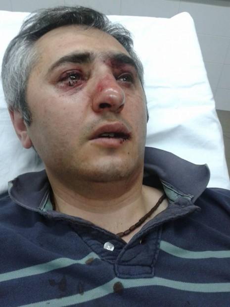 На митинге в Ереване жестоко избит доцент-арабист