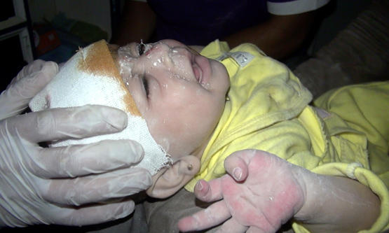 В Сирии из-под обломков здания извлекли живого младенца