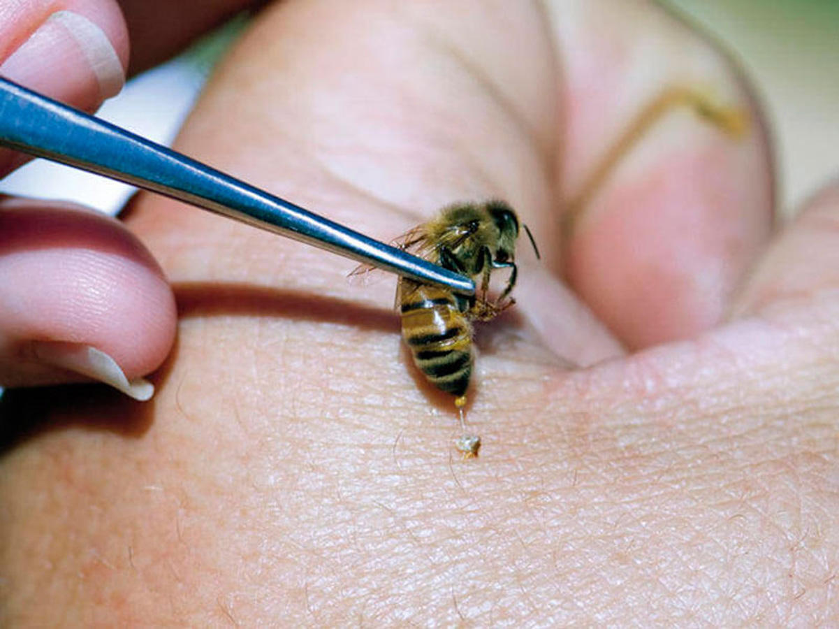 Эффективное лечение пчелами