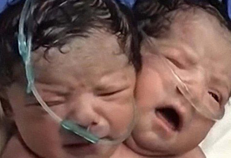 В Мексике родился малыш, плачущий двумя голосами
