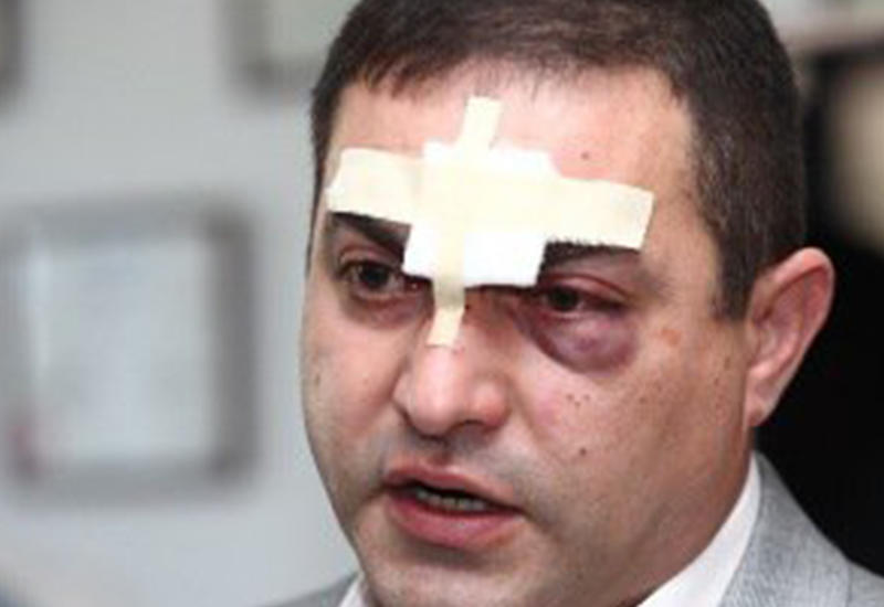 Зверски избитому армянскому адвокату предложили деньги за молчание