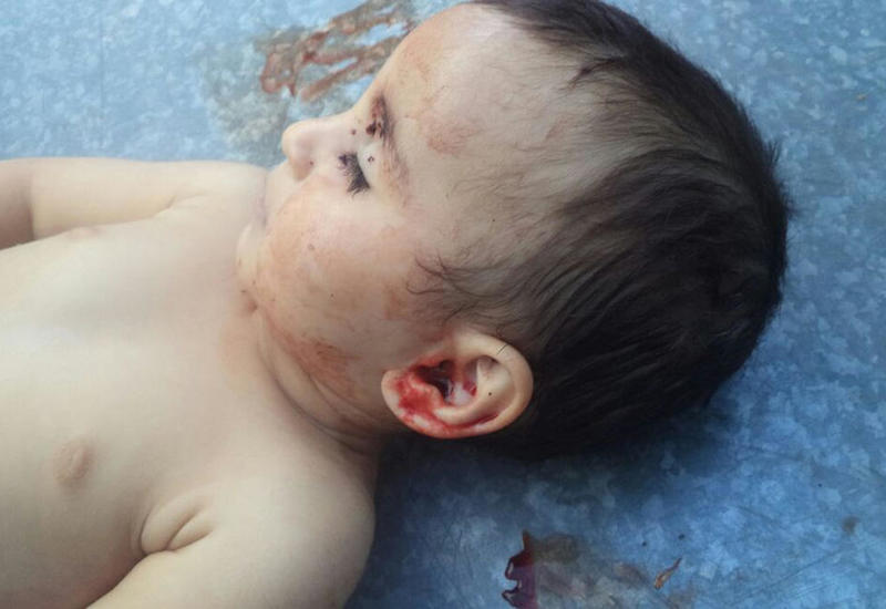 В армянских соцсетях издеваются над смертью азербайджанского ребенка