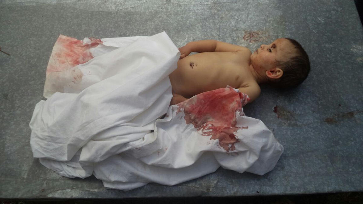 Мир жестко отреагировал на убийство маленькой Захры: такого оккупанты не ожидали
