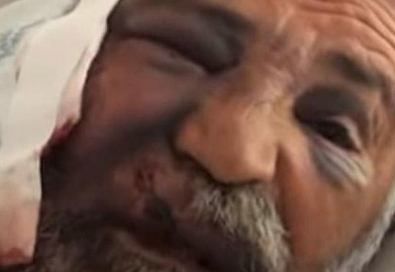 "Dişləri dodağımla gözümün altına düşdü" - canavarı boğaraq öldürən 61 yaşlı kişi