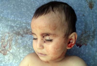 UNICEF отреагировал на убийство армянами 2-летней Захры