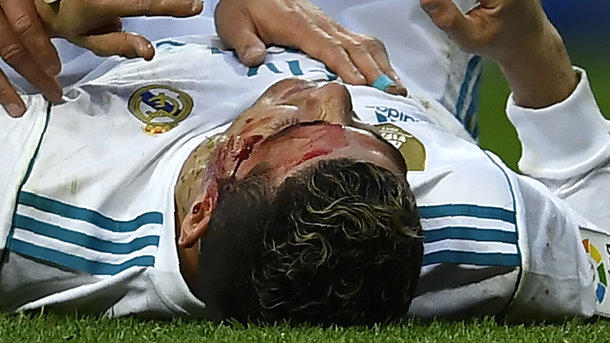 Криштиану Роналду разбили голову в матче чемпионата Испании