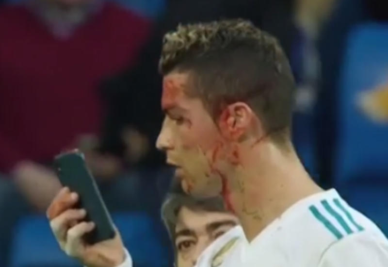 Роналду уткнулся в телефон, получив ногой по лицу на футбольном поле