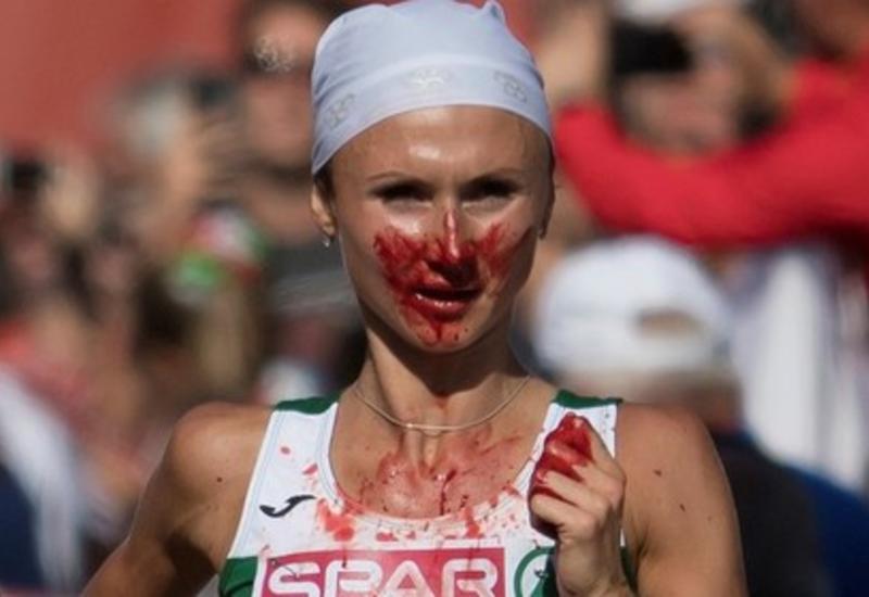 Бегунья истекла кровью и выиграла марафон на чемпионате Европы