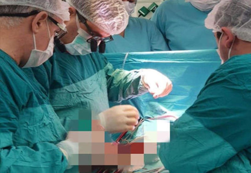 В Азербайджане пациенту впервые пересадили искусственное сердце
