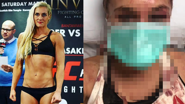 QadÄ±n dÃ¶yÃ¼ÅÃ§Ã¼nÃ¼n Ã¼zÃ¼nÃ¼ 