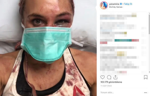 QadÄ±n dÃ¶yÃ¼ÅÃ§Ã¼nÃ¼n Ã¼zÃ¼nÃ¼ 