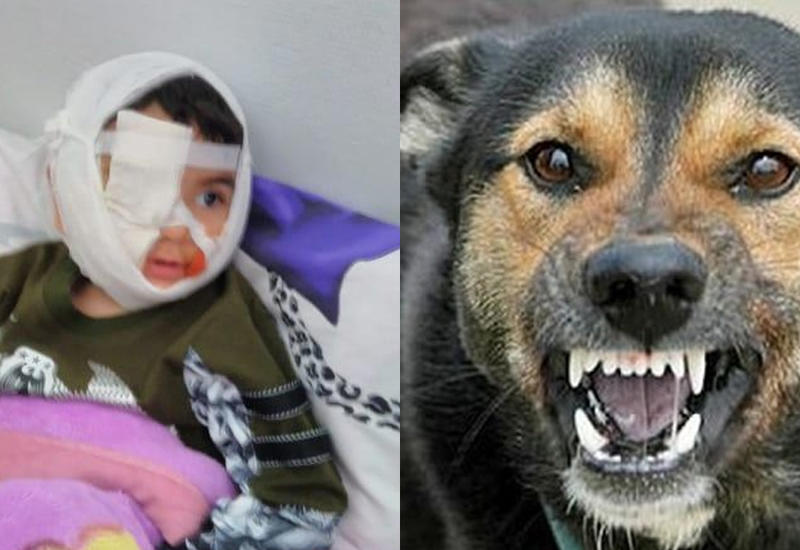 Азербайджанцев возмутило жестокое нападение бешеной собаки на ребенка