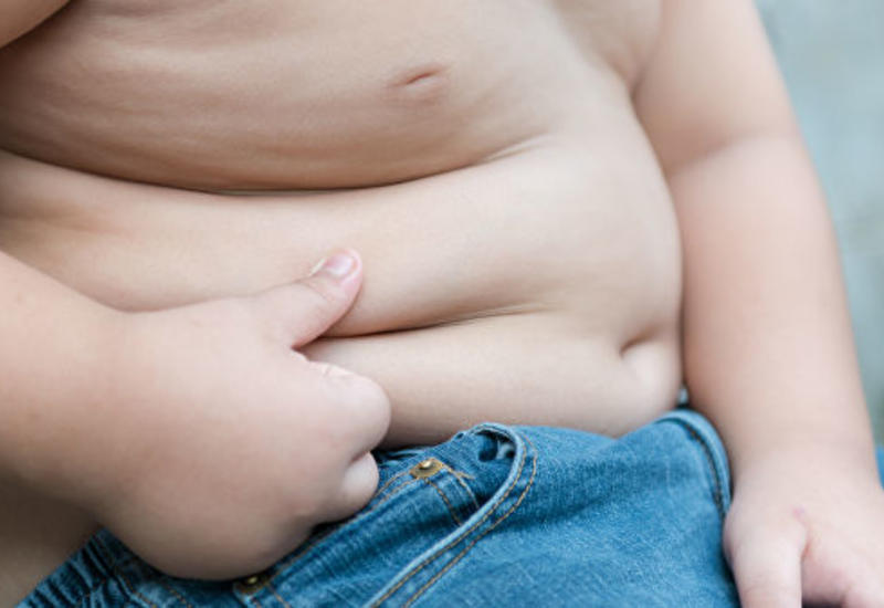 Врачи назвали главные ошибки, приводящие к ожирению