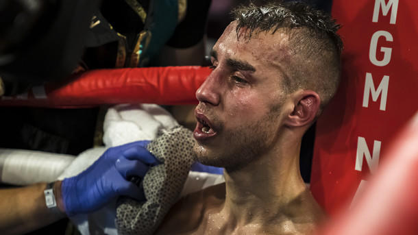 Боксер Дадашев в критическом состоянии после боя: ему удалили часть черепа
