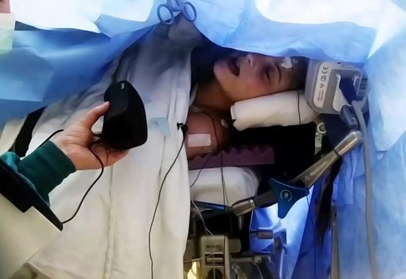 Эта девушка проснулась во время операции на мозг - врачи были шокированы тем, что она сделала дальше