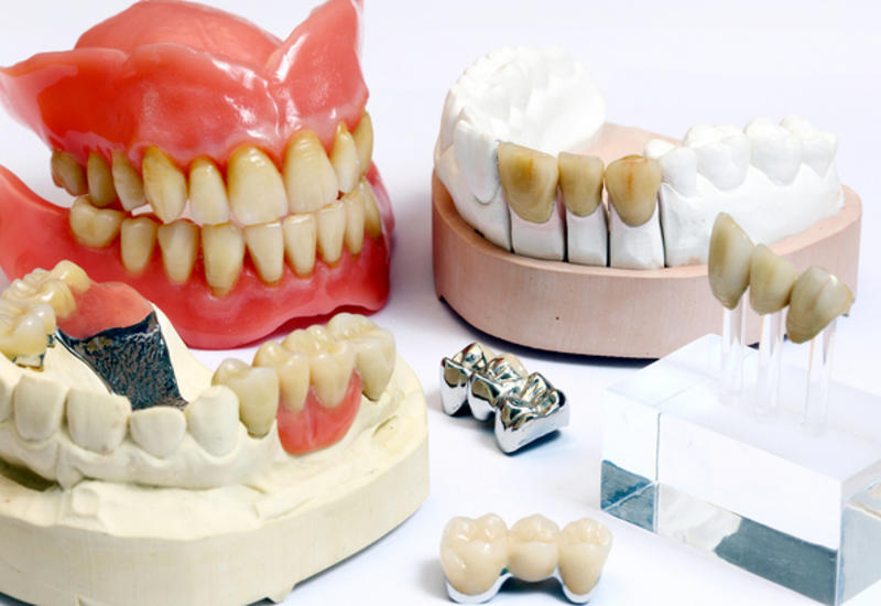 Зубные коронки назвали возможной причиной возникновения рака
