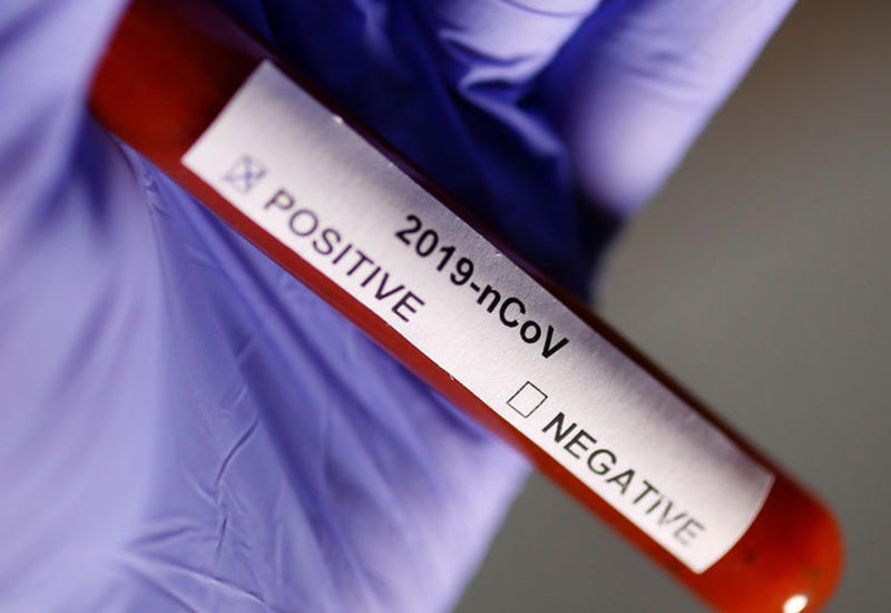 Первый случай заражения коронавирусом зафиксирован в Каталонии