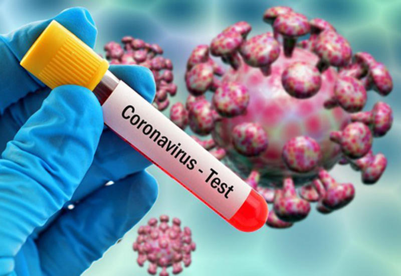 Французские ученые создали убивающий свыше 90% коронавируса в воздухе «медальон»