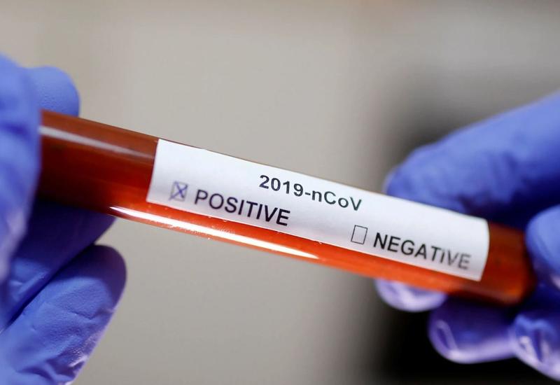 В Беларуси проведено более 30 тыс. тестов на коронавирус