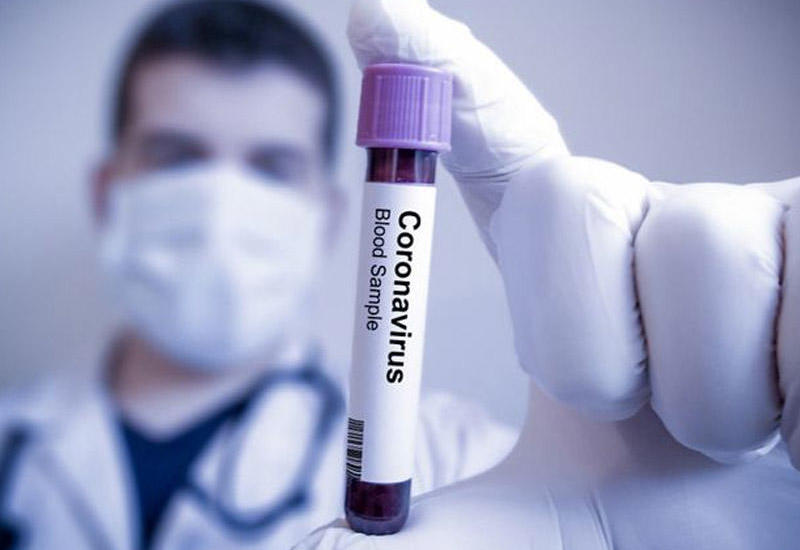 Как с помощью экспресс-анализов ученые собираются обуздать эпидемию коронавируса