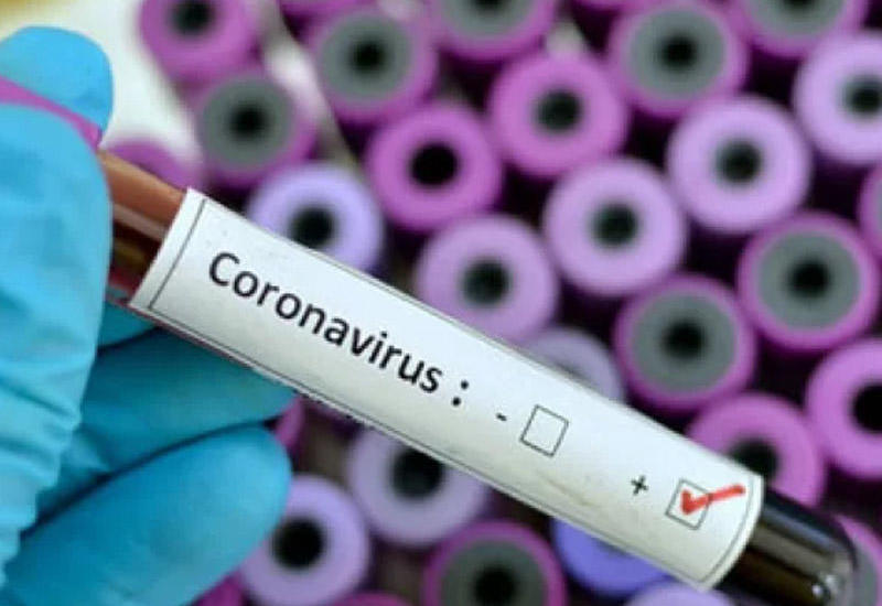 Главный инфекционист США предупредил о возможной новой волне коронавируса осенью
