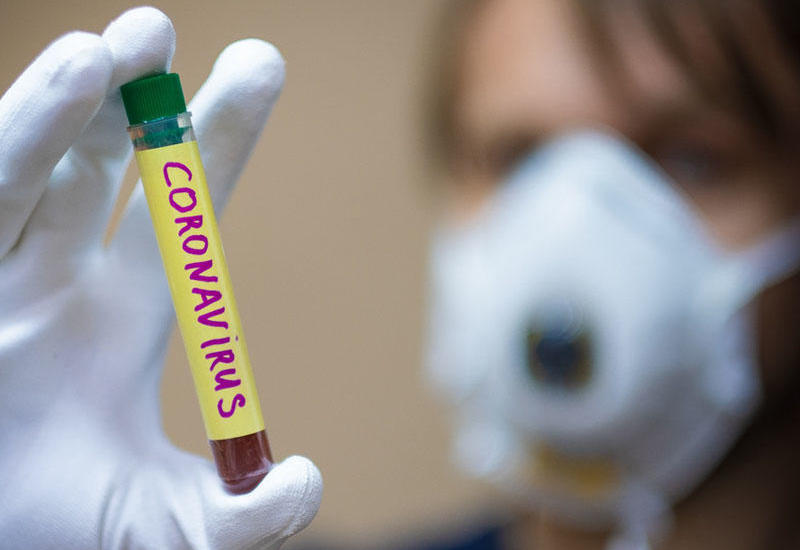 Qırğızıstanda koronavirusdan ilk ölüm halı qeydə alınıb
