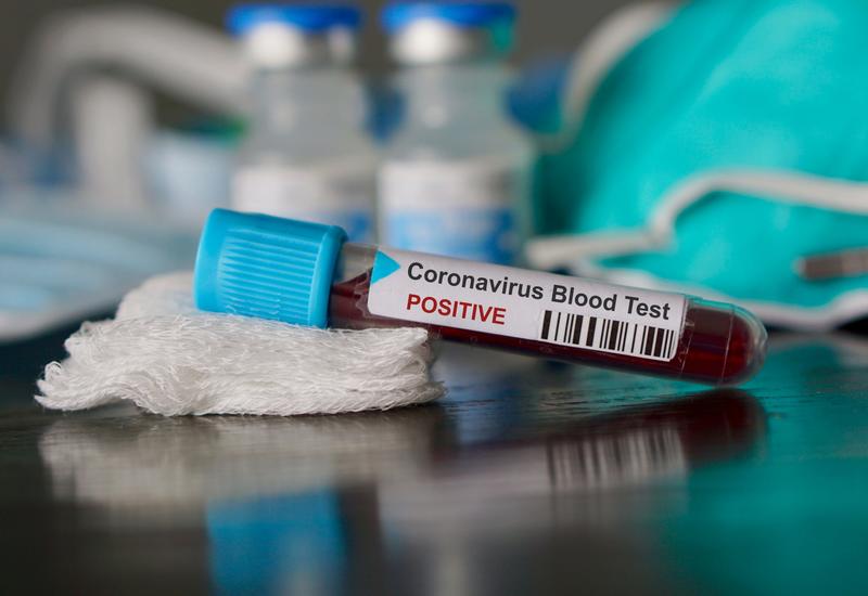 Число заразившихся коронавирусом в Европе превысило 687 тыс.