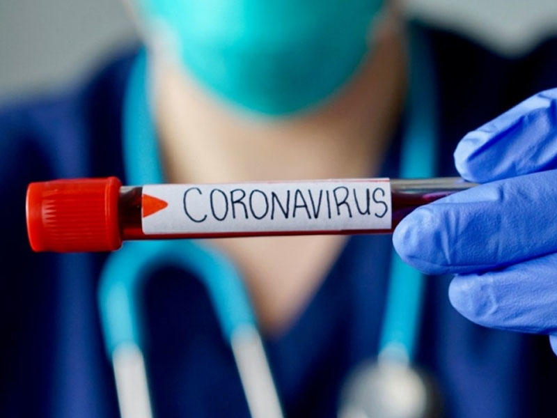 В Азербайджане выявлено 588 новых случаев заражения коронавирусом, 346 вылечившихся, 7 скончались