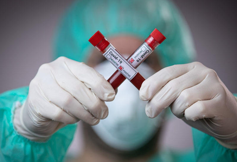Qırğızıstanda daha 71 nəfər koronavirusa yoluxub