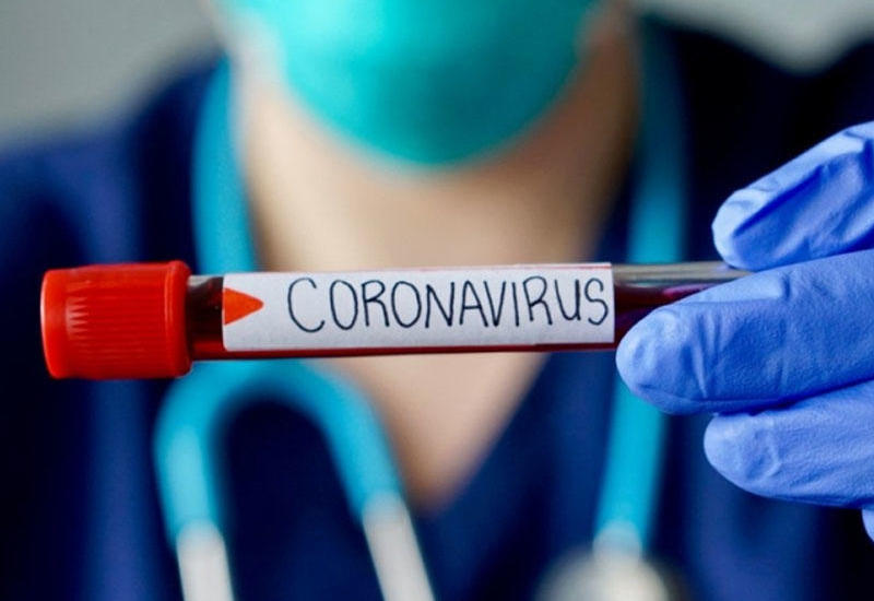 Azərbaycanda 143 nəfər koronavirusa yoluxdu 44 nəfər sağaldı, 3 nəfər vəfat etdi