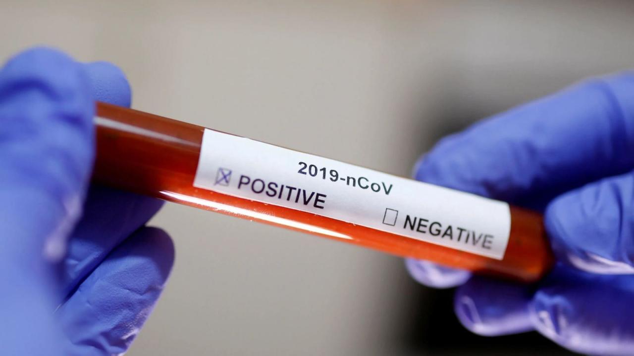США сделают важное заявление о вакцине от коронавируса