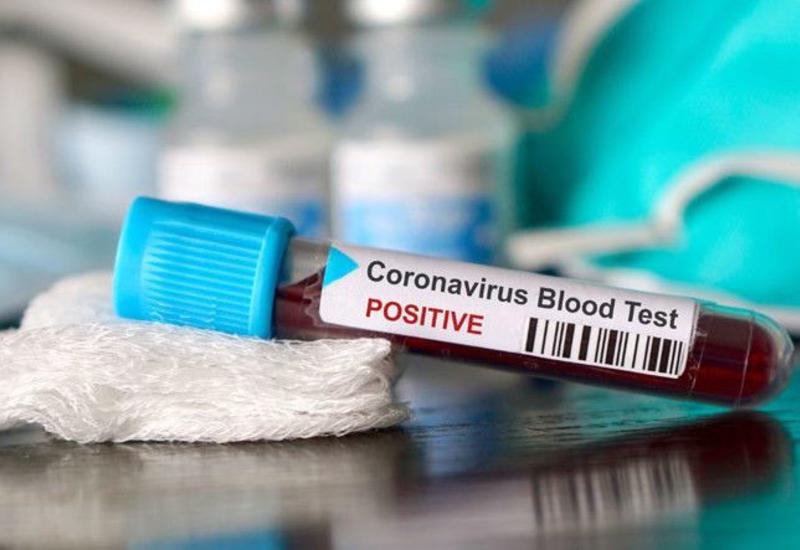 Число инфицированных коронавирусом в Грузии достигло 539