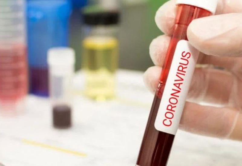 В Азербайджане выявлено 548 новых случаев заражения коронавирусом, 491 вылечившихся, 10 человек скончались