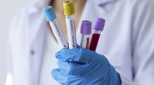 TƏBİB назвало количество проведенных тестов на коронавирус