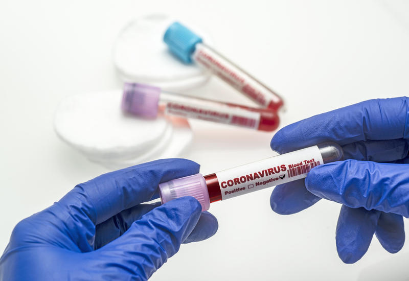 TƏBİB назвал количество проведенных тестов на коронавирус