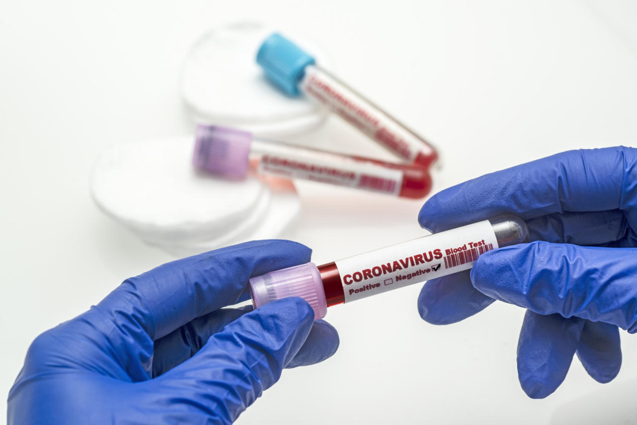TƏBİB назвал количество проведенных тестов на коронавирус