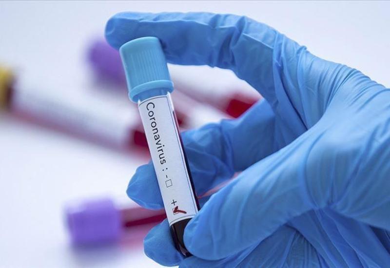 В Азербайджане названо количество проведенных тестов на коронавирус